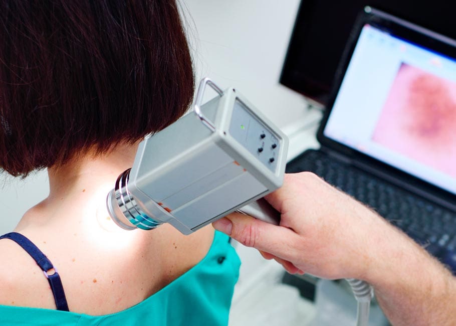 Mole Mapping - FotoFinder | Harpenden Medical